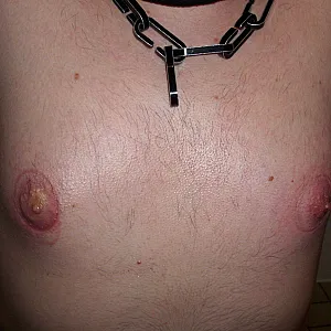 wunde Nippel Galeriebild