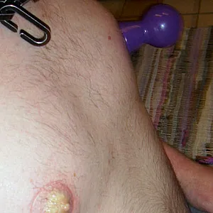 wunde Nippel Galeriebild