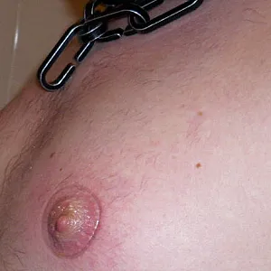 wunde Nippel Galeriebild