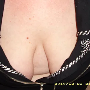 my boobs again gallery image