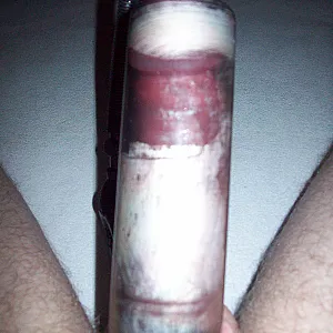 cock vacuum pump until i cum gallery image