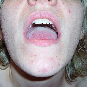 das liebt sie sehr Galeriebild