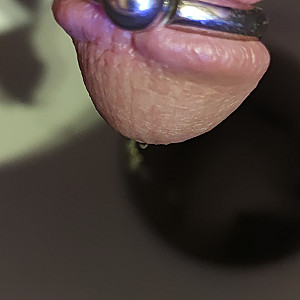 my dick gallery image
