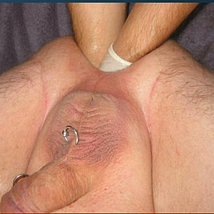 fisting gallery image