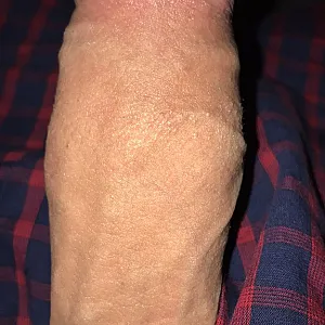 my cock gallery image