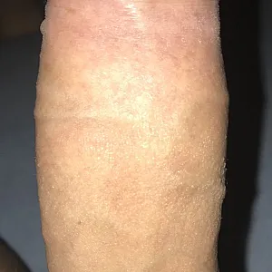my cock gallery image