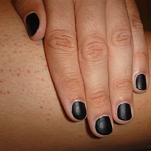 Hand-Art Galeriebild