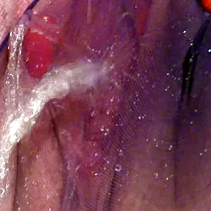pee gallery image