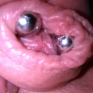 my cock gallery image