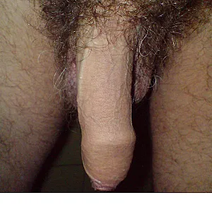 Close ups gallery image