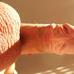 Erection and close up Galeriebild
