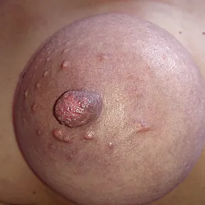 bounded tits gallery image