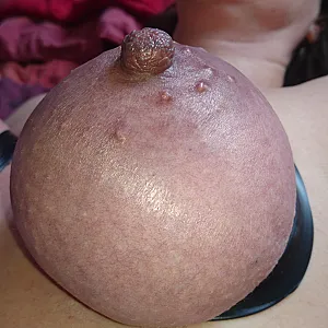 bounded tits gallery image