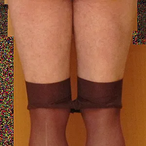 Strumpfhose runter 04 Galeriebild