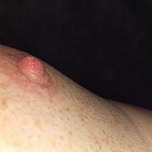 Nippel Alarm Galeriebild
