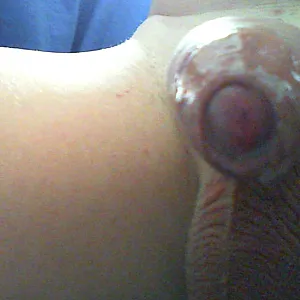 my dick gallery image