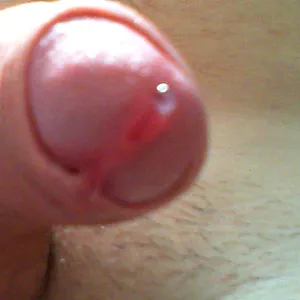 my dick gallery image