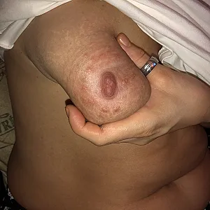 my titts gallery image