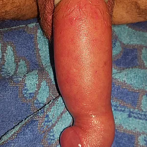 First image of spanko's Gallery - pumped cock