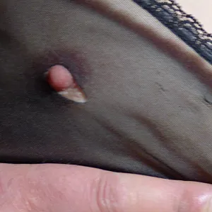 nipples gallery image