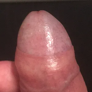 my cock gallery image