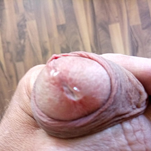 my cock gallery image