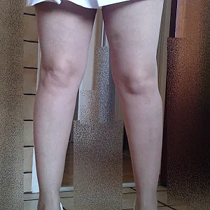 sommer outfit Galeriebild