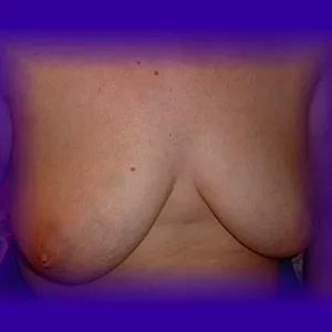 other pics gallery image