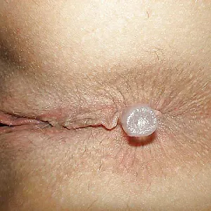 suppository for me 2 Galeriebild