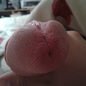 my penis gallery image