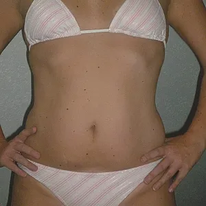 small strip at home gallery image