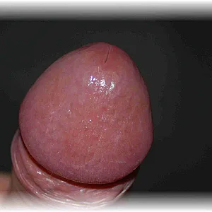 closeups gallery image