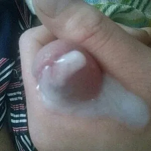 dick gallery image