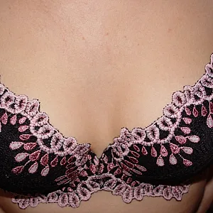 Nipples Galeriebild