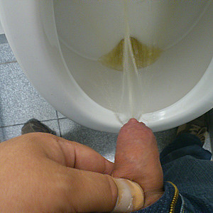 Pissbilder Galeriebild