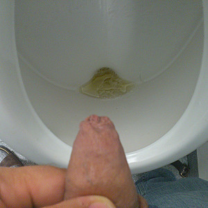 Pissbilder Galeriebild