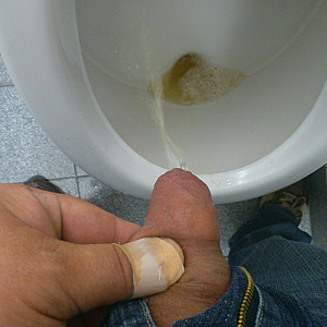 Pissbilder Galeriebild