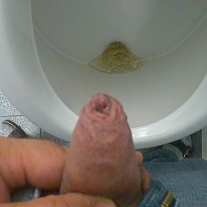Pissbilder Galeriebild