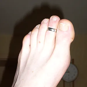 showing feets gallery image