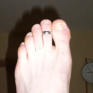showing feets gallery image