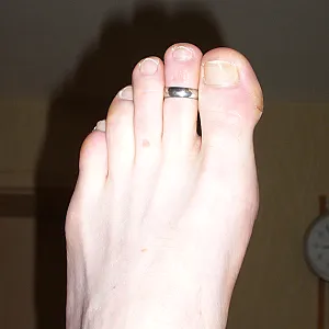 showing feets gallery image