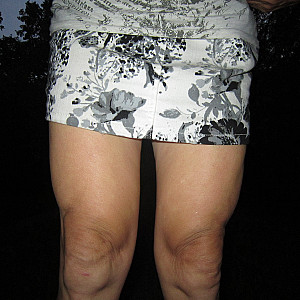 Special - That's me, wearing a miniskirt gallery image