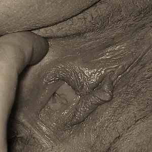 pics 2 gallery image