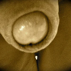 closeups gallery image