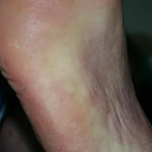 footimpressions gallery image