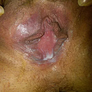 Cunt gallery image