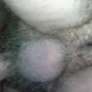 hairy thing gallery image