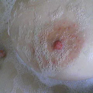 my tits gallery image
