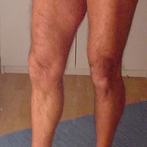 new amateur cd gallery image
