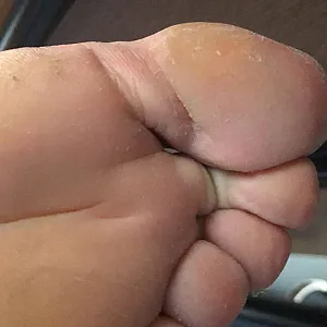 Birkenstock slut Galeriebild